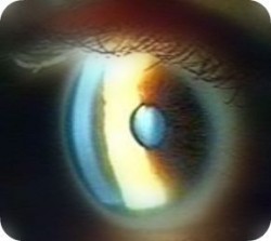 Ботевградчанинът д-р Веселин Даскалов  организира безплатни очни прегледи за глаукома в  болница Токуда